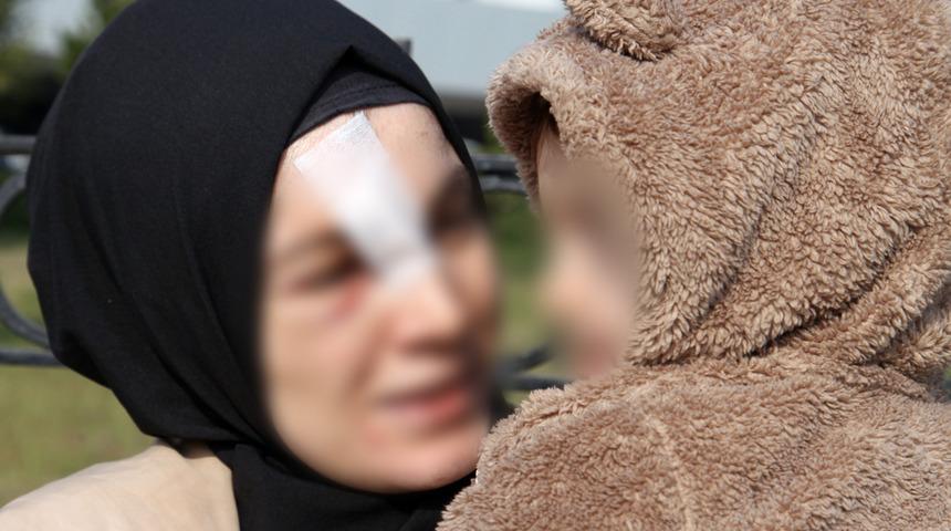 Cinsel ilişki teklifini reddettiği kocası tarafından dövülmüştü! Koruma altına alındı