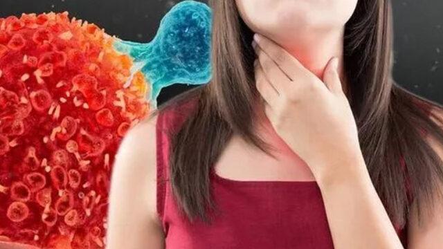 Yemek borusu kanserinin ilk belirtisidir! 'Gecikmeden doktorunuza görünün'