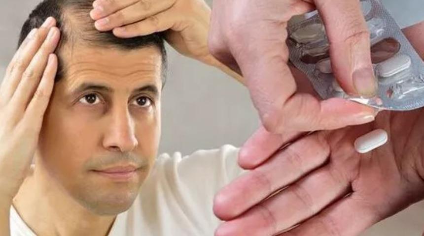 Saç dökülmesini tersine çeviriyor: Uzmanı saçların çıkması sağlayan yöntemi paylaştı