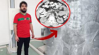 Kol ve koltuk altından gelen yoğun koku ele verdi! Hepsi midesinden çıktı