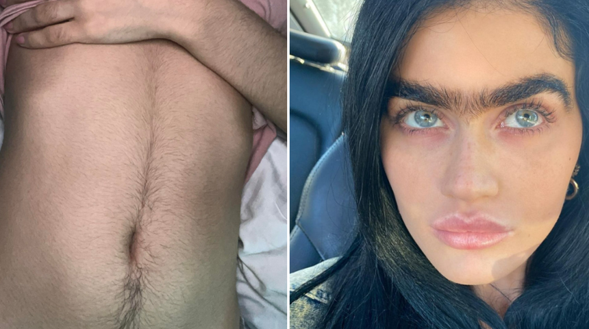 Jiletsiz bir yaşamı benimseyerek v&uuml;cut kıllarını almayı bırakan kadınlar yaşadıklarını anlattı