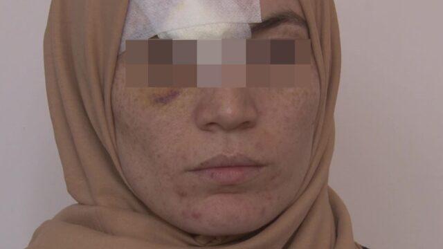 Kocası zorla birlikte olmak istedi, istemeyince darp edildi! 'Gönlümü hoş tutacaksın' deyip...