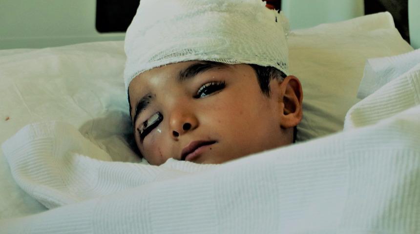 Gaziantep'te korkunç olay! Sokak köpeği 6 yaşındaki çocuğun saç derisini kopardı