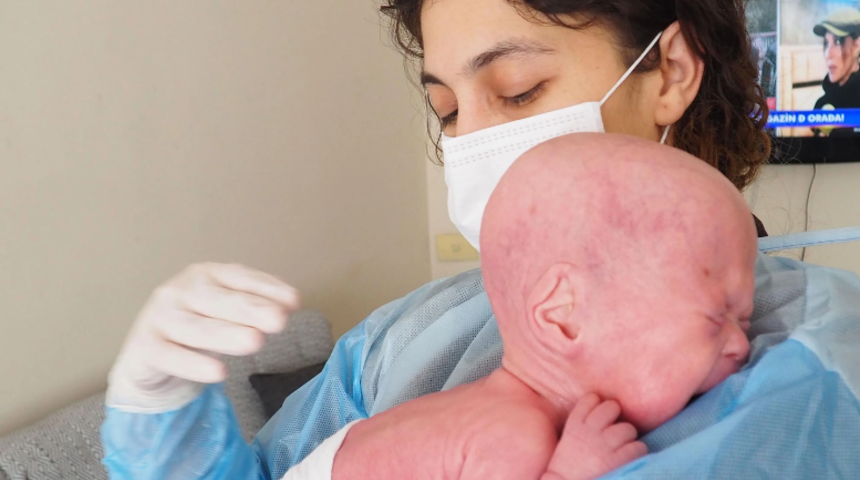 'Yılan bebek' olarak doğunca babası DNA istemişti! Rapor belli oldu... Dede, kayyum olarak atandı!