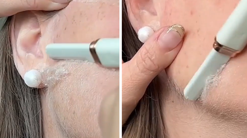 TikTok'ta kardeşinin y&uuml;z&uuml;ndeki t&uuml;yleri tıraş etti: Dermaplaning hakkında herkesin merak ettiği soru aynı... Y&uuml;zdeki t&uuml;yleri almak daha kalın &ccedil;ıkartır mı?