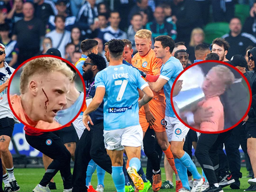 Derbide taraftarlar sahaya girdi, y&uuml;z&uuml;ne metal kovayla vurulan kalecinin y&uuml;z&uuml; kesildi! D&uuml;nya, Avustralya'da yaşanan skandalı konuşuyor...