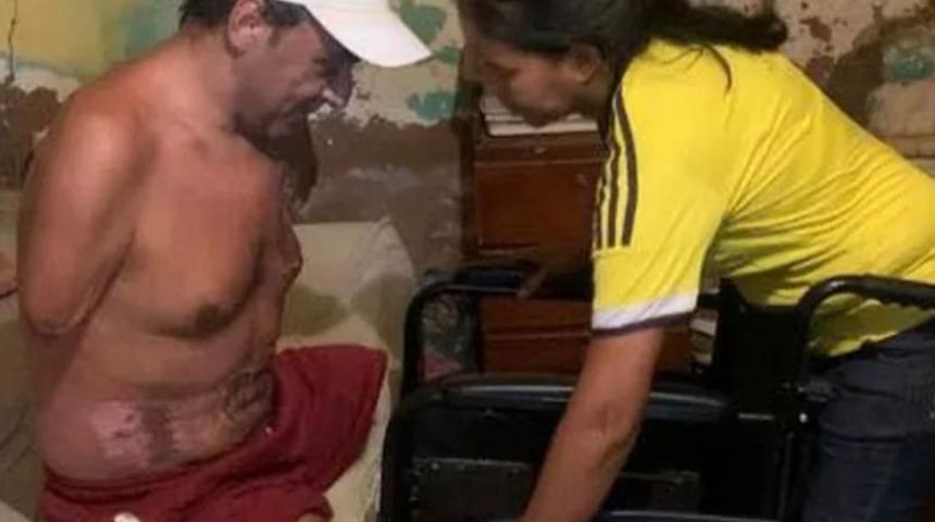 Vücuduna yayılan binlerce voltluk elektrik ondan tüm uzuvlarını aldı! Ama canını değil...