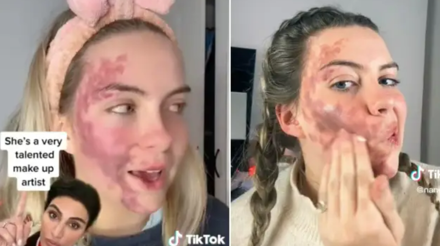 TikTok'ta hastalığını paylaştı! Dermatolog tarafından sahtekarlıkla suçlandı