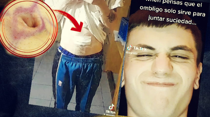 Sonunda bu da oldu! Vücut modifikasyonları sınır tanımıyor... “Göbek deliğimi ameliyatla aldırdım”