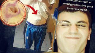 Sonunda bu da oldu! Vücut modifikasyonları sınır tanımıyor... “Göbek deliğimi ameliyatla aldırdım”