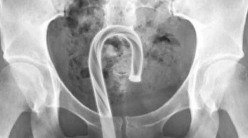 Tehlikeli trend giderek yayılıyor! Mastürbasyon hakkında uyarı verildi