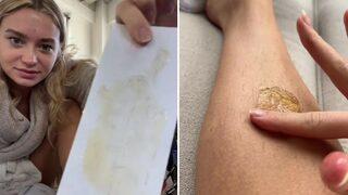 TikTok'ta tüm püf noktalarıyla yaptığı ağdayı paylaştı! İstenmeyen tüylerin 2 ay çıkmamasını sağlıyor