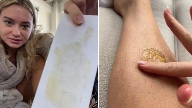 TikTok'ta tüm püf noktalarıyla yaptığı ağdayı paylaştı! İstenmeyen tüylerin 2 ay çıkmamasını sağlıyor