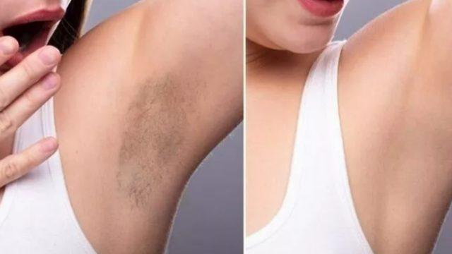 Cilt kararmalarını bembeyaz yapacak! Japonların cilt beyazlatma sırrı