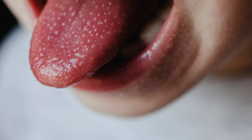 Ölümcül Strep A salgını artarken her ebeveynin bilmesi gereken belirtiler! Erken önlem alın