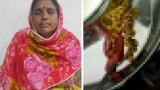 Her şey sırt ağrısıyla başladı! Safra kesesinden tam 382 taş çıkartıldı... Görenler inanamıyor