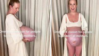 Karnını TikTok hesabı üzerinden paylaşan kadın büyük övgü topladı! Bu kadın bir süper kahraman