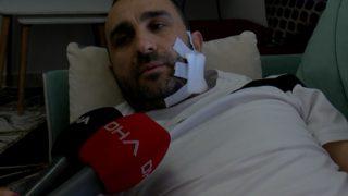 Park kavgasında silahla yüzünden yaralanmıştı! Dehşet anlarını anlattı: Sebepsiz bir olayda polis silah çekti