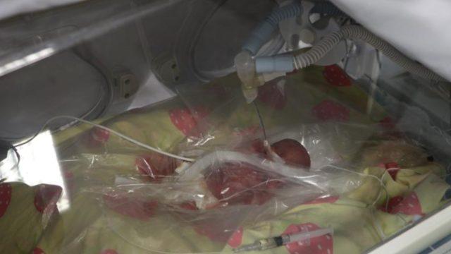 Dünyada ve Türkiye'de sayılı bebeklerden! Tam 310 gram doğdu... 7/24 gözlem altında 