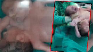 İki başlı, dört kollu ve iki bacaklı olarak dünyaya gelen yapışık ikiz kardeşler doktorları bile şaşkına çevirdi