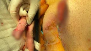 Göbeğinde yeniden büyütüldü! 3 haftada yeniden oluştu: Karnıma gömdüler