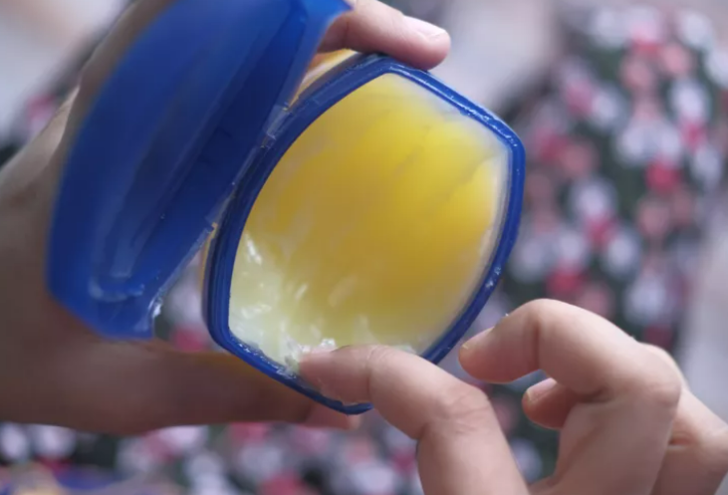 Çatlamış topukları anında pamuk gibi yapacak! Çatlamış topuklardan kurtulmak için doğal çözümler G3