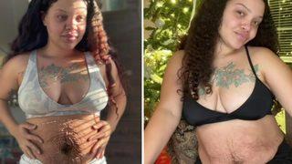 Karnını görenler ameliyat olması için zorluyor! “Herkesin doğum sonrası vücudu farklıdır