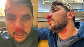 Hemşireye yumruk atıp hastaneyi kan gölüne çevirdi! 'Yatağın başını kaldır' diye emir verince...