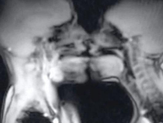 Hastanede MRI cihazında seks yaptılar! Görüntüler şoke etti