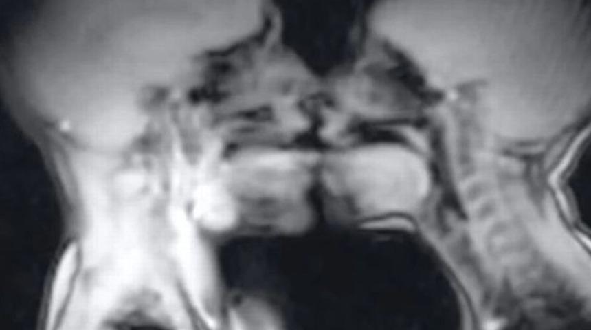 Hastanenin MRI cihazında cinsel ilişkiye giren çiftin görüntüleri şoke etti! 