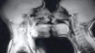 Hastanenin MRI cihazında cinsel ilişkiye giren çiftin görüntüleri şoke etti! 