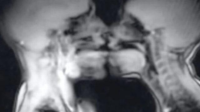 Hastanenin MRI cihazında cinsel ilişkiye giren çiftin görüntüleri şoke etti! 