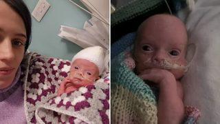 Mucize bebek! Annesinin karnındayken ölüydü... Canlı doğunca herkesi şoke etti