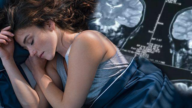 Uykuya dikkat! İnme geçiren hastaların yarısından fazlası aynı belirtiyi yaşamış