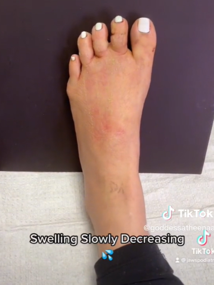 Sonunda bu da oldu! Parmak kısaltma ameliyatı oldu... Tepkilerin hedefine yerleşti G3