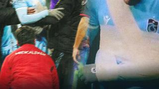 Trabzonspor'un yıldızı Edin Visca sakatlandı ve hastaneye kaldırıldı! 