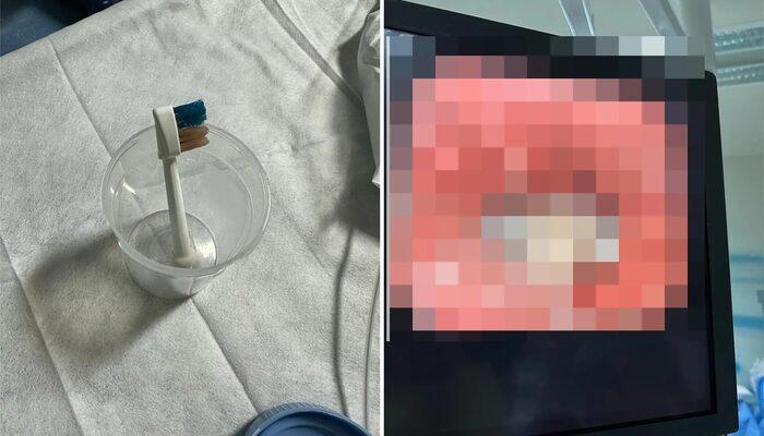  9 yaşındaki &ccedil;ocuğun bağırsaklarında &ouml;yle bir şey bulundu ki...