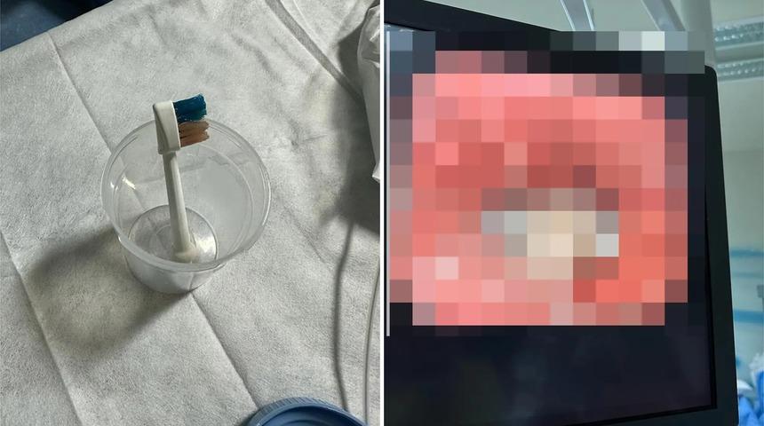 ''Bunun burda ne işi var?'' Doktorlar 9 yaşındaki çocuğun bağırsaklarında öyle bir şey buldu ki...