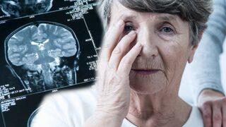 Her şey önceden hissediliyormuş! Alzheimer'ın en erken belirtilerine dikkat