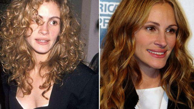 55 yaşındaki Julia Roberts botoks yaptırmadan sağladığı gençlik sırrını paylaştı! Favorisi karbonat...