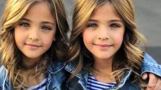 Dünyanın en güzel ikizleri artık büyüdü! Son halleri sosyal medyayı salladı... Bir gören bir daha bakıyor