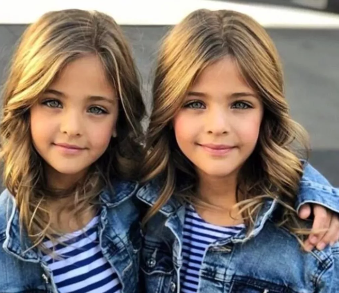 D&uuml;nyanın en g&uuml;zel ikizleri artık b&uuml;y&uuml;d&uuml;! Son halleri sosyal medyayı salladı... Bir g&ouml;ren bir daha bakıyor