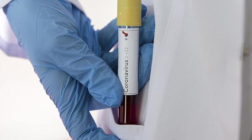 Kovid-19'dan ölenlerin beyninde virüs saptandı iddiası! Araştırmanın sonucu dikkat çekti