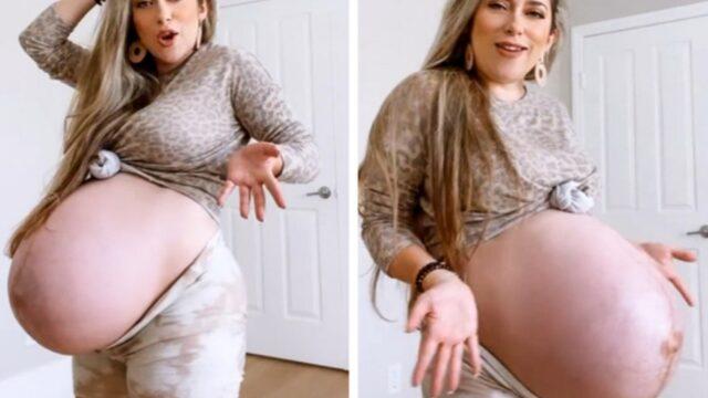 Karnının 'iğrenç' olduğunu söylüyorlar: Kontrol edemediğiniz fiziksel değişiklikten geçmek zor