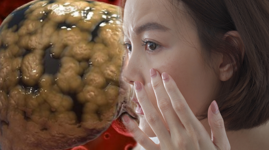 Cildinizde ortaya çıkan değişimlere dikkat! Tehlikeli hastalığın büyük uyarıcısı 