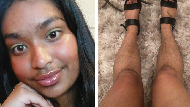 İstenmeyen tüylerini almayı bırakarak vücuduyla barışan 15 kadın