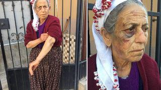 Kanser hastası yaşlı kadını dakikalarca dövüp gasp etti, sözleri 'pes' dedirtti! 'Alkollüydüm şansımı denedim'
