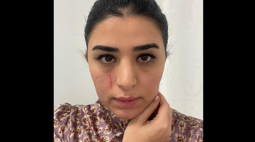 Görev başındaki kadın doktoru darbettiler! Olayla ilgili 2 kişi gözaltına alındı