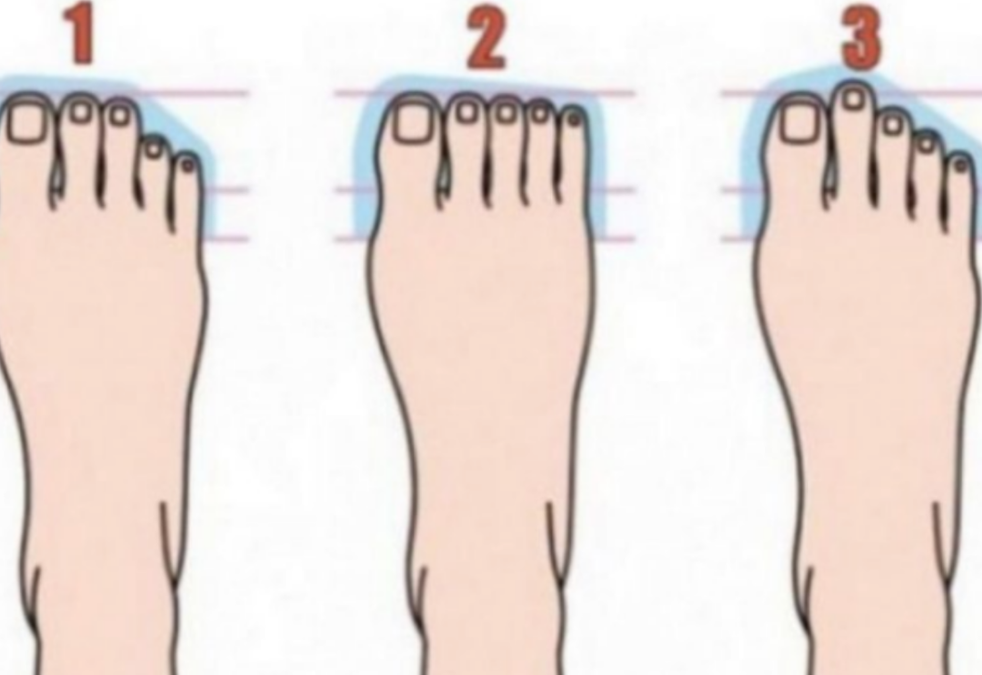 Ayak parmaklarınızın şekline g&ouml;re karakter analizi