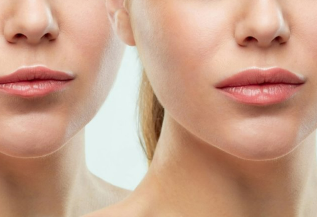 Hi&ccedil; aklımıza gelmemiş: Evde en kolay dudak b&uuml;y&uuml;tme y&ouml;ntemi! Dudak dolgunlaştırmak i&ccedil;in...